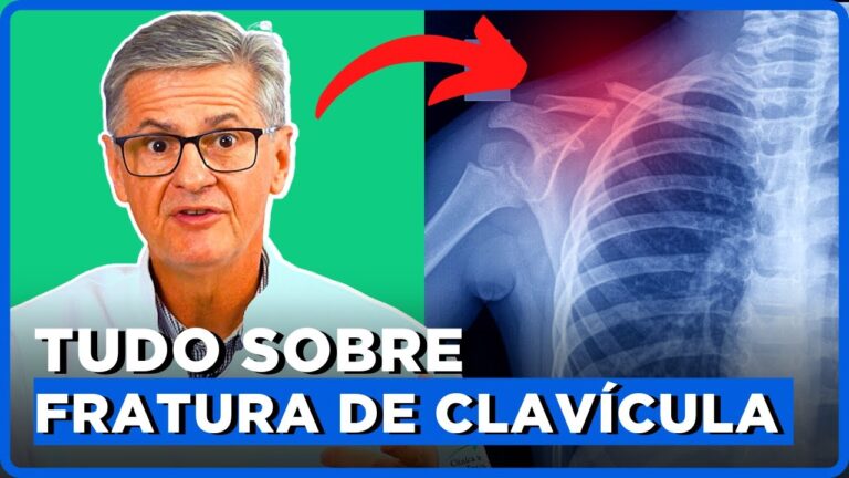 Tempo de recupera&ccedil;&atilde;o da fratura de clav&iacute;cula