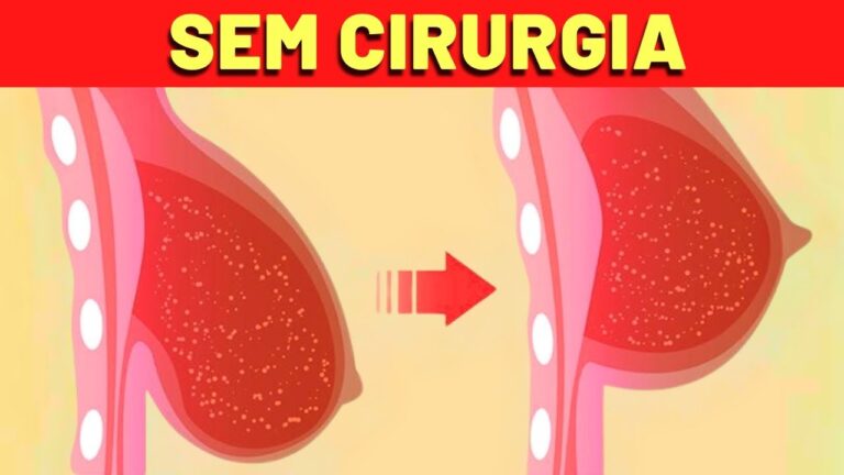 7 Maneiras Naturais de Aumentar o Tamanho dos Seios Sem Cirurgia