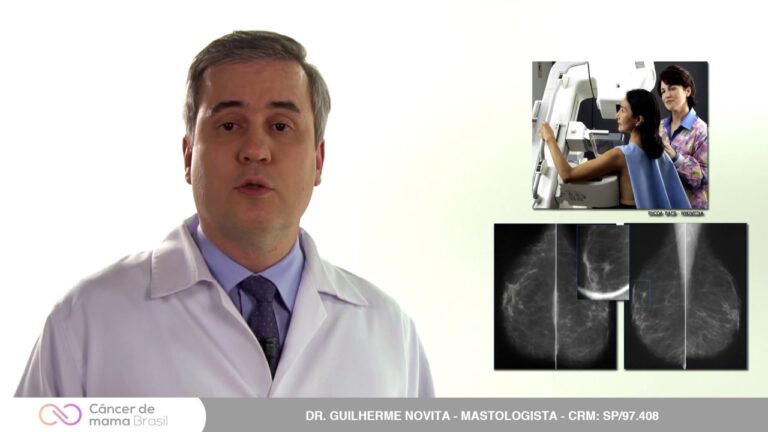Diagnóstico e Tratamento do Carcinoma de Mama Grau 2