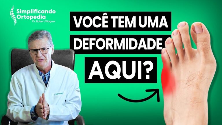 Joanete no Dedinho: Causas e Tratamentos