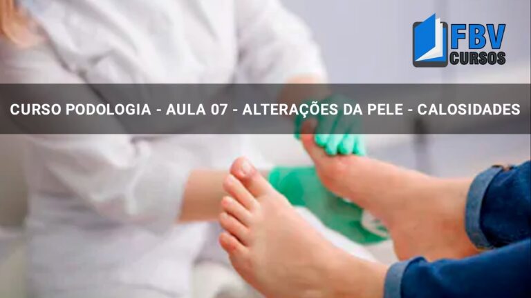 Entendendo a Forma&ccedil;&atilde;o de Calos: Causas e Preven&ccedil;&atilde;o
