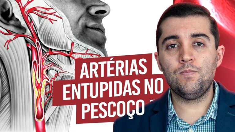 Car&oacute;tidas Entupidas: Causas e Tratamentos