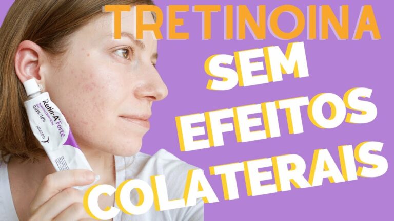Guia Completo sobre Tretino&iacute;na em Portugal