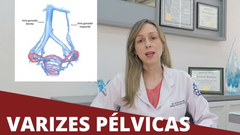 O papel do especialista em varizes p&eacute;lvicas na sa&uacute;de da mulher