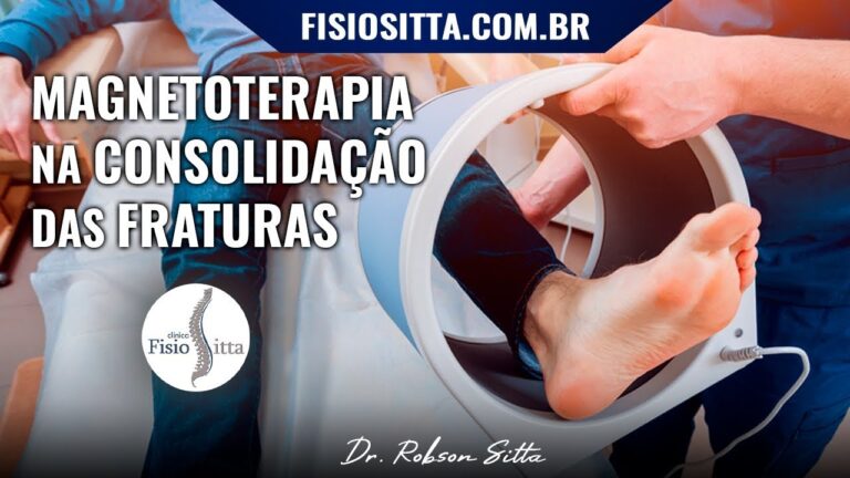 Magnetron em Fisioterapia: Benef&iacute;cios e Aplica&ccedil;&otilde;es