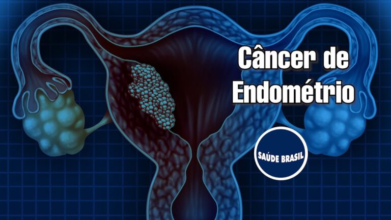 Diagn&oacute;stico de C&acirc;ncer de Endom&eacute;trio: Import&acirc;ncia das Fotos
