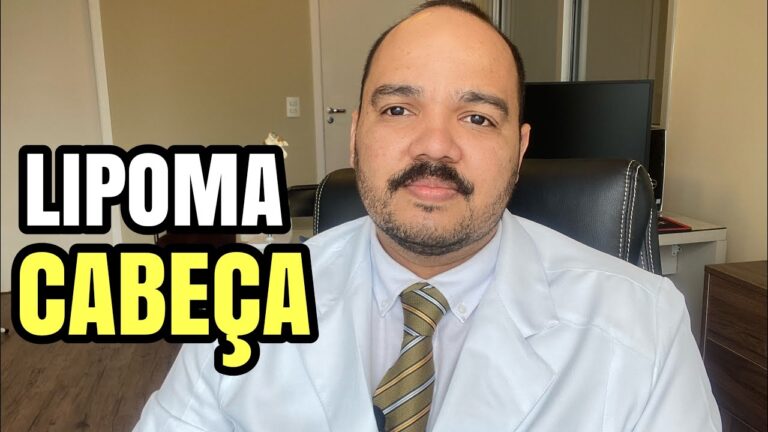 Descoberta de Cisterna Supraeselar: O Que Você Precisa Saber