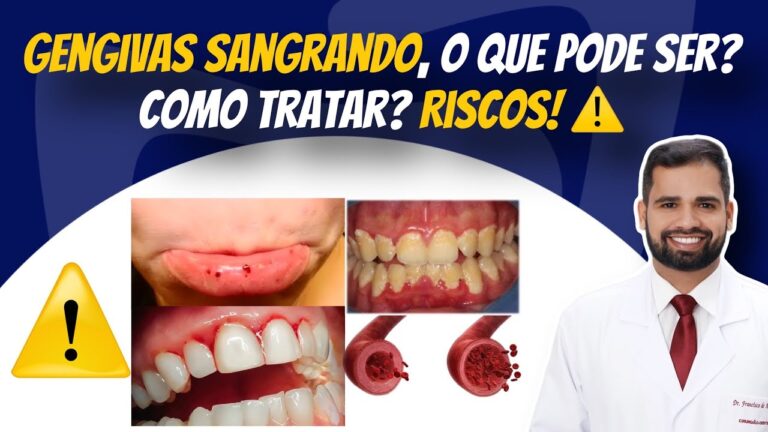 Como Parar o Sangramento das Gengivas: Guia Pr&aacute;tico
