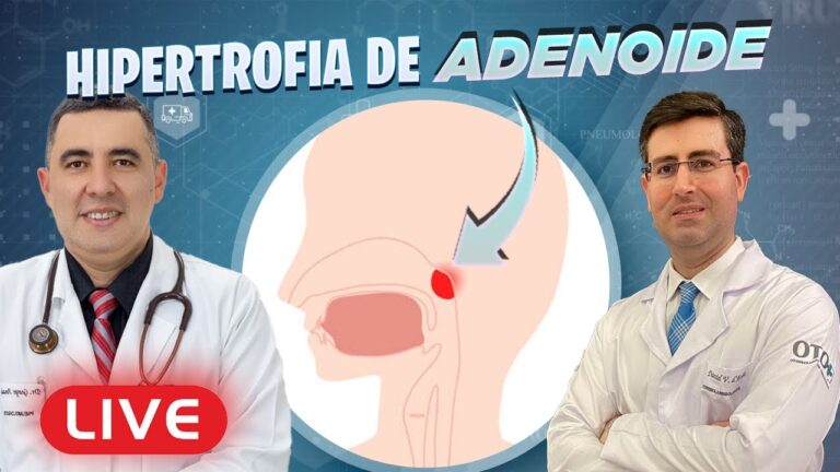 Guia Completo da Hipertrofia da Laringe