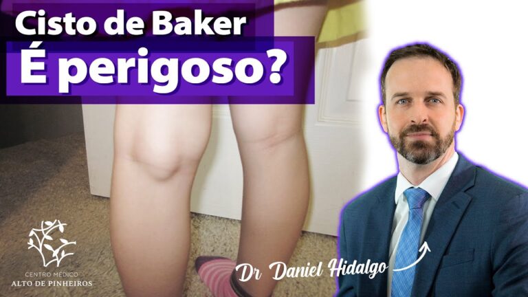Quisto: O M&eacute;todo Inovador para o Tratamento de Les&otilde;es no Joelho