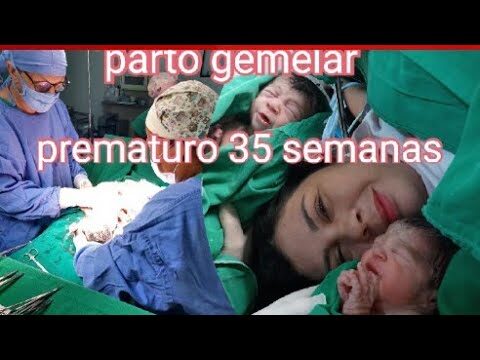 Gesta&ccedil;&atilde;o gemelar: tudo o que precisa saber &agrave;s 35 semanas