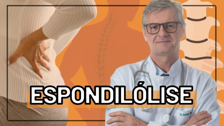 Sintomas da Espondilose Lombar