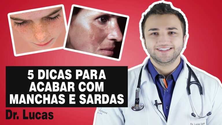 Guia Completo para Remover as Sardas Naturalmente
