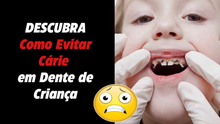 Cuidados Essenciais para Dentes Podres em Crian&ccedil;as
