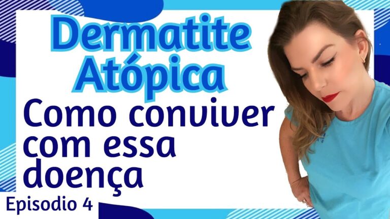 Tratamento eficaz da dermatite at&oacute;pica com hidrocortisona