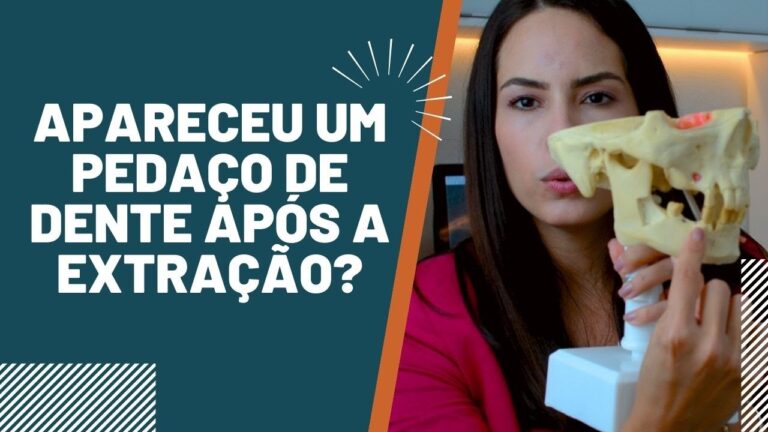 Osso aparecendo na gengiva: causas e tratamentos