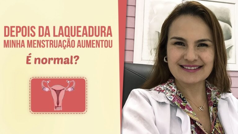 Menstrua&ccedil;&atilde;o ap&oacute;s laqueadura: O que esperar