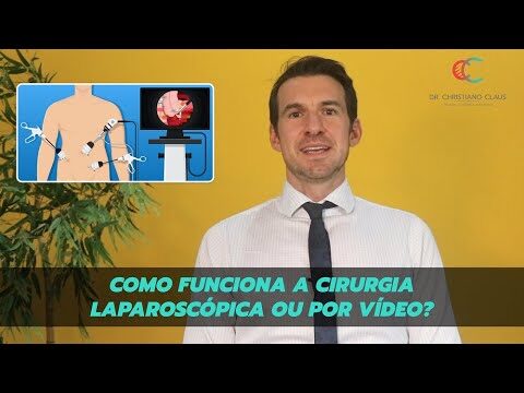 Avan&ccedil;os e Benef&iacute;cios da Cirurgia Laparosc&oacute;pica