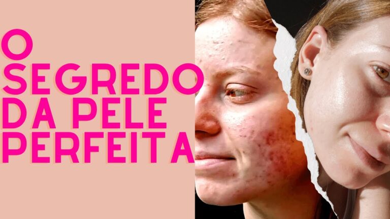 Transformação com Benzac: Antes e Depois