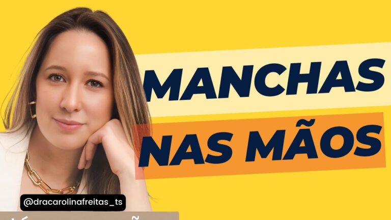 Como Remover Manchas na Mão Eficazmente