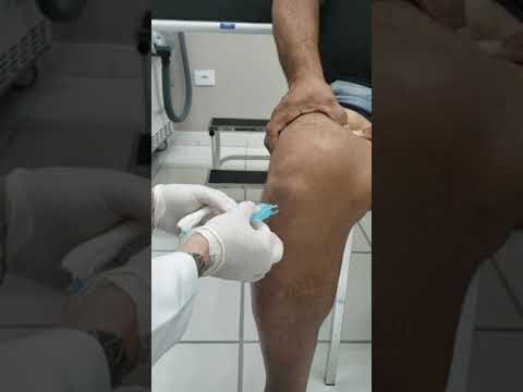 Benef&iacute;cios da inje&ccedil;&atilde;o intra-articular no joelho