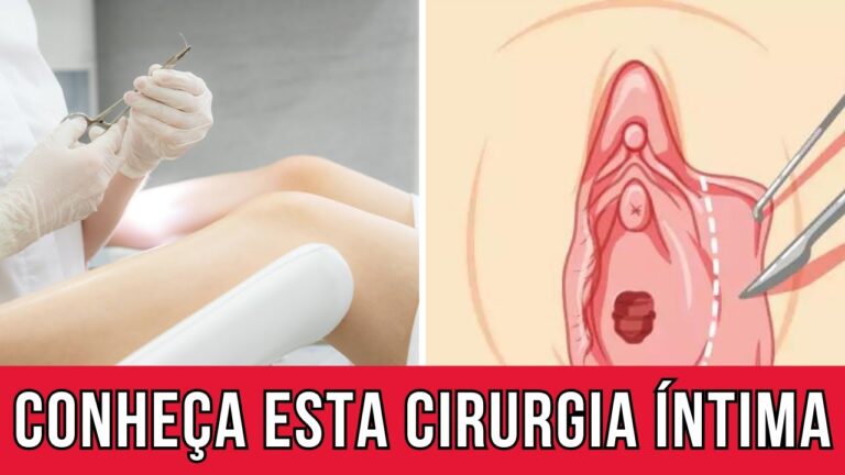 Transforma&ccedil;&atilde;o da Cirurgia &Iacute;ntima Feminina