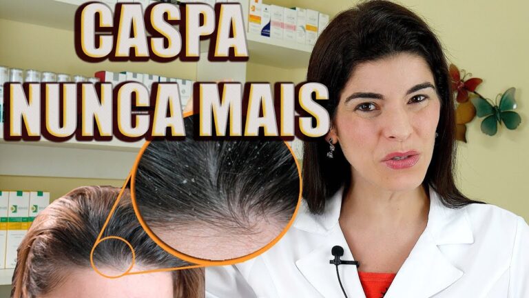 Tratamentos Caseiros Eficazes para Combater a Caspa