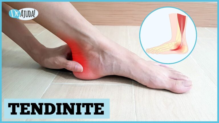Sintomas de inflama&ccedil;&atilde;o no tend&atilde;o do p&eacute;