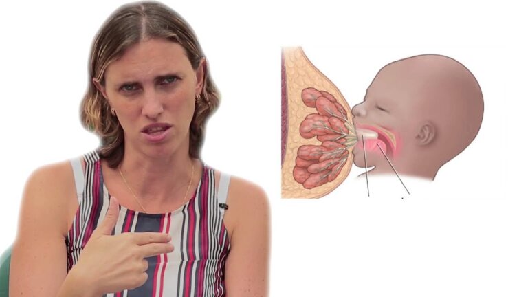 Entendendo a Inflama&ccedil;&atilde;o dos Ductos Mam&aacute;rios