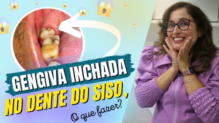 Como Aliviar o Incha&ccedil;o do Dente do Siso
