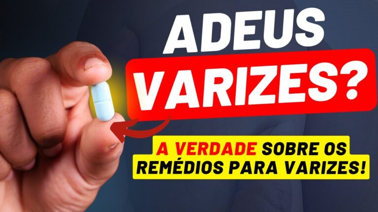 Tratamentos Eficazes para Varizes nas Pernas