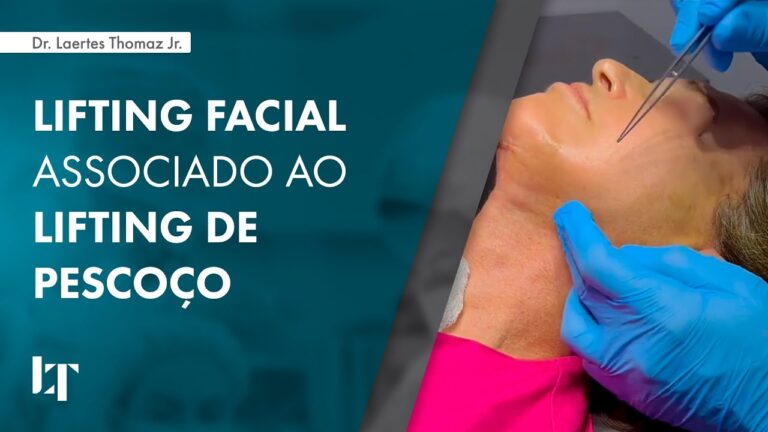 Transforma&ccedil;&atilde;o Instant&acirc;nea: Fotos de Lifting de Rosto