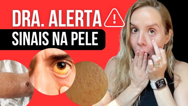 Falta de Vitamina D e Suas Manchas na Pele