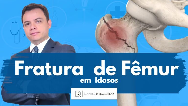 Complica&ccedil;&otilde;es da Fratura de F&ecirc;mur: O Que Voc&ecirc; Precisa Saber