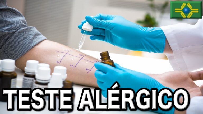 Vacina para Alergia a &Aacute;caros: Pre&ccedil;os e Op&ccedil;&otilde;es Dispon&iacute;veis