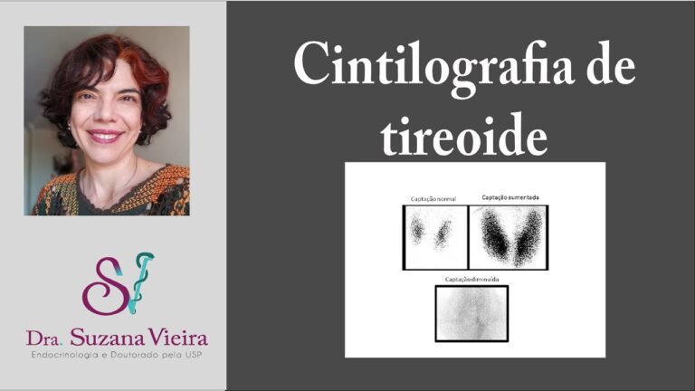 Cintigrafia Tiroideia: Diagn&oacute;stico Eficaz e Avan&ccedil;os Tecnol&oacute;gicos