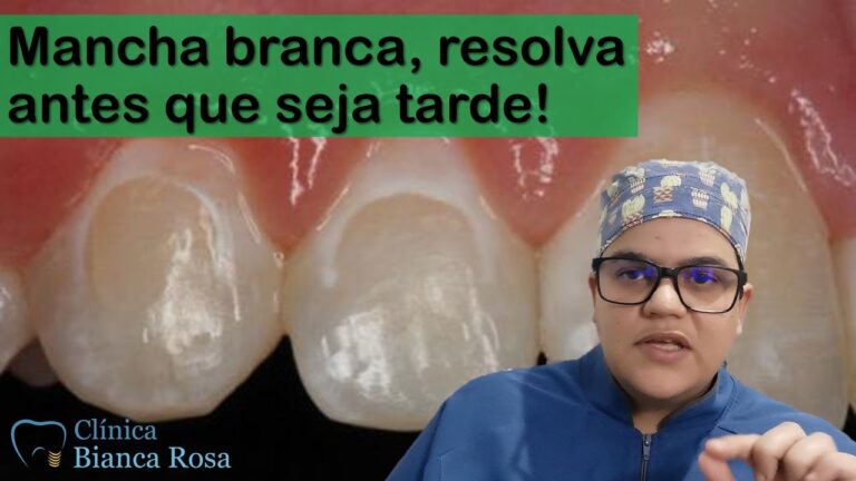 Causas e Tratamentos da Gengiva Branca ao Redor do Dente