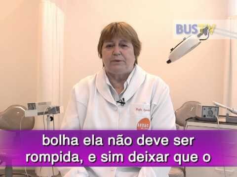 Como Resolver Calos nos P&eacute;s de Forma Eficiente