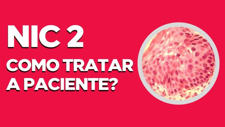 Tratamento Eficaz para HPV NIC 2