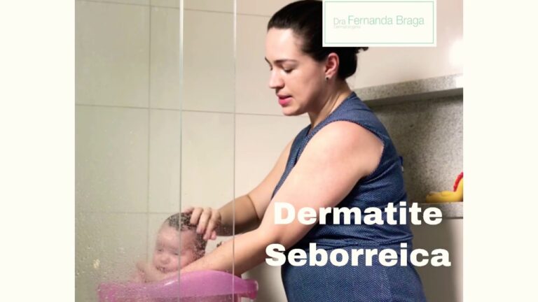 Shampoo Eficaz para Dermatite Seborreica Infantil