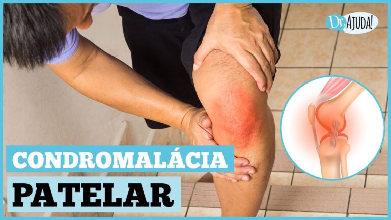 Tratamento Eficaz para Cartilagem Inflamada no Joelho