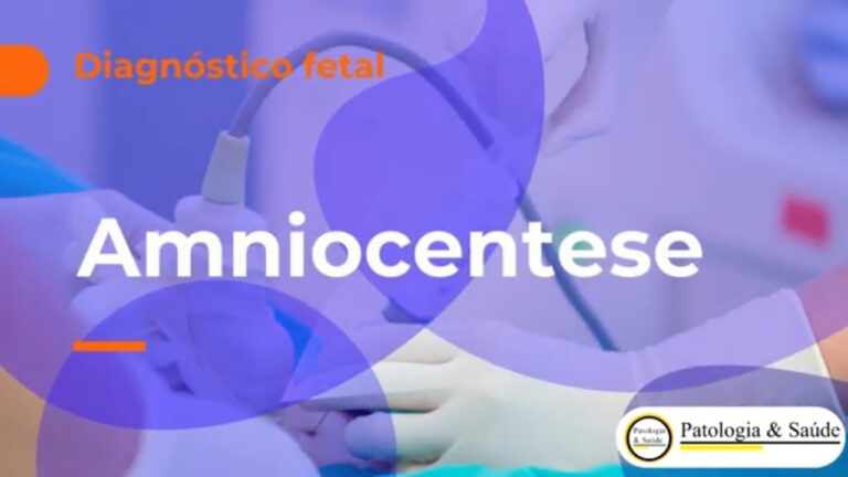Amniocentese: Onde Realizar o Procedimento?