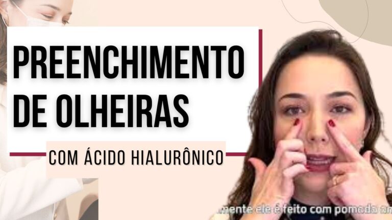 &Aacute;cido Hialur&ocirc;nico: Benef&iacute;cios para a Sa&uacute;de Ocular
