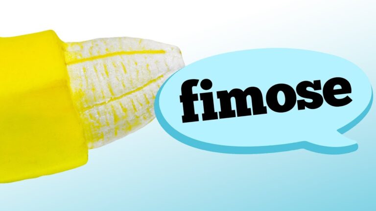 Tratamento Eficaz para Fimose de 2 Grau