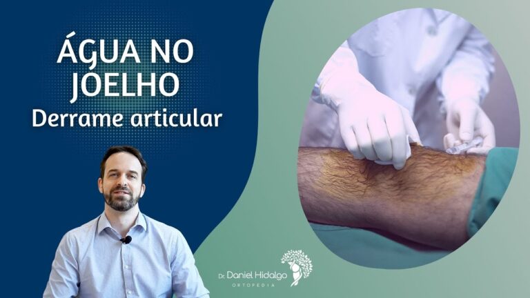 Recupera&ccedil;&atilde;o do Derrame Articular no Joelho: Tempo e Cuidados