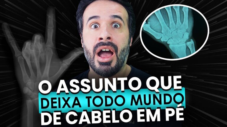 Articula&ccedil;&atilde;o Intercarpica: Estrutura e Fun&ccedil;&atilde;o na M&atilde;o