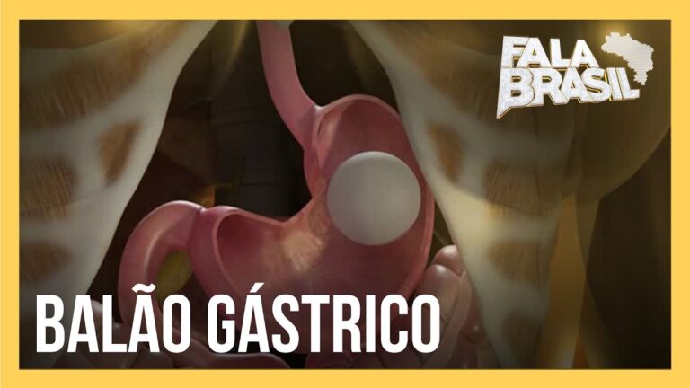 Riscos do Bal&atilde;o G&aacute;strico: O Que Voc&ecirc; Precisa Saber