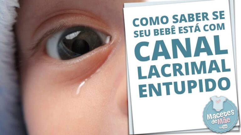 Entendendo a Inflama&ccedil;&atilde;o do Canal Lacrimal