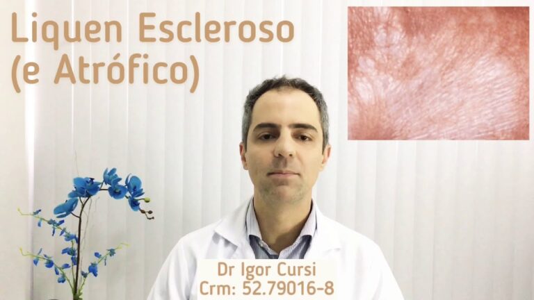 L&iacute;quen Escleroso: Entendendo e Reconhecendo os Sintomas Atrav&eacute;s de Fotos
