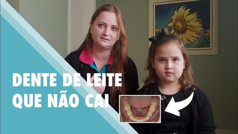 Dentes de Leite que N&atilde;o Caem: Causas e Solu&ccedil;&otilde;es